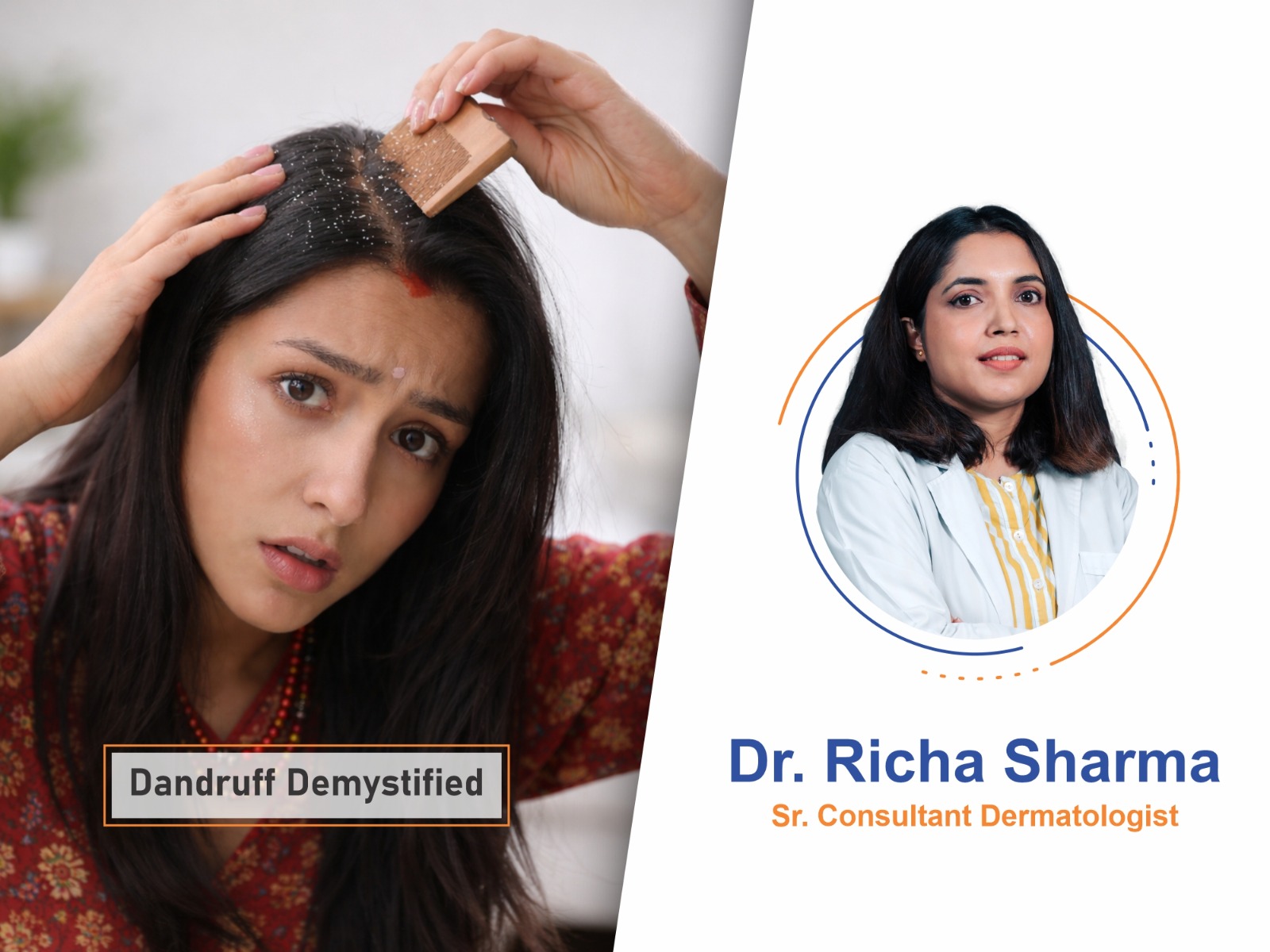 Dandruff Demystified