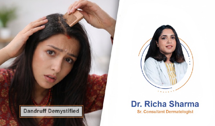 Dandruff Demystified